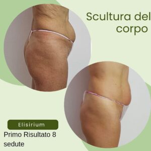 Centro estetico elisirium il meglio a Latina 10