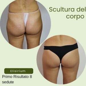 Centro estetico elisirium il meglio a Latina 11