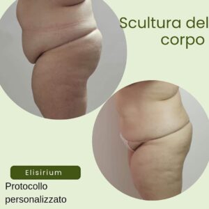 Centro estetico elisirium il meglio a Latina 12